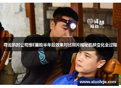 尊龙凯时公司维E擦脸半年后效果对比照片揭秘肌肤变化全过程 尊龙凯时公司维E擦脸半年后效果对比照片揭秘肌肤变化全过程